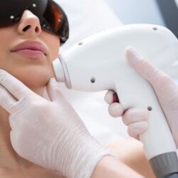Laser Hair Removal for Men in Dubai