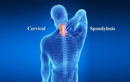 cervical cervical
