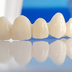 cosmetic_dentist_new_canaan_ct_zirconia_crowns_migrated