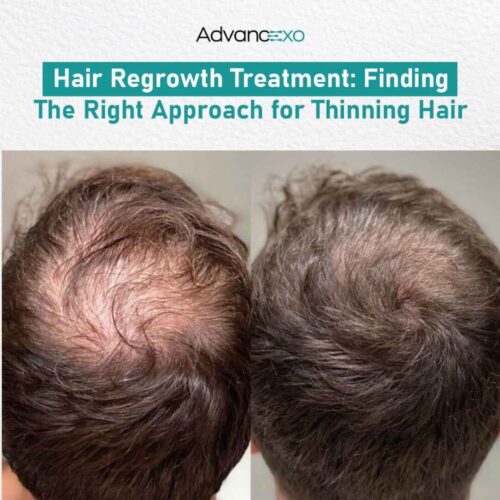 Hair Regrowth Treatment (2) Hair Regrowth Treatment (2)