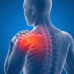 frozen shoulder