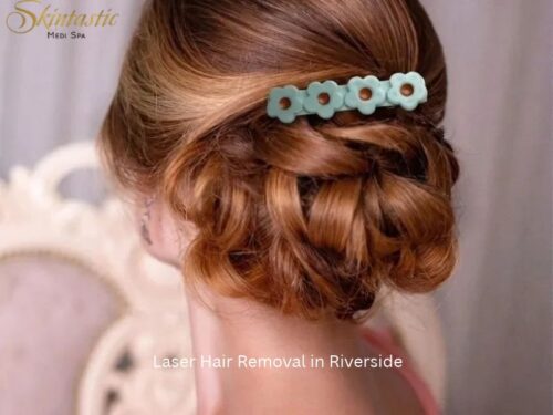 Laser Hair Removal in Riverside (1) Laser Hair Removal in Riverside (1)