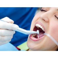 dental bonding in Bergen County NJ