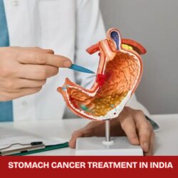 Stomach Cancer Treatment in India