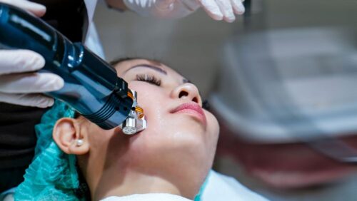 Radiofrequency Microneedling in Dubai Radiofrequency Microneedling in Dubai