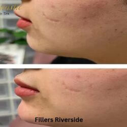 Fillers Riverside