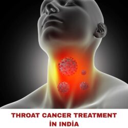 Throat Cancer Treatment in India (1)