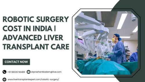 Robotic Surgery Cost in India Advanced Liver Transplant Care (1) Robotic Surgery Cost in India Advanced Liver Transplant Care (1)