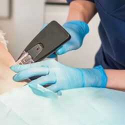 skincarelasercentre BLOG (1)