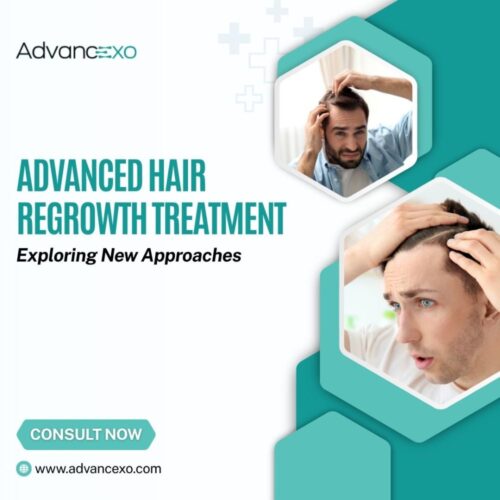 Advanced Hair Regrowth Treatment Advanced Hair Regrowth Treatment