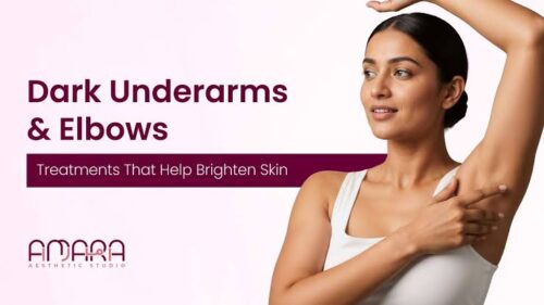 dark elbow dark elbow