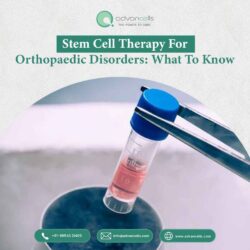 Stem Cell Therapy for Orthopaedic Disorders