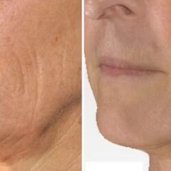skincarelasercentre BLOG